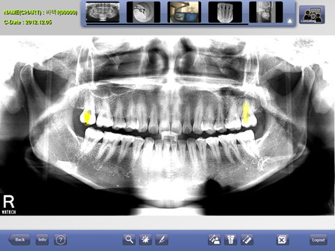 EasyDent M Ver2.0 screenshot 3