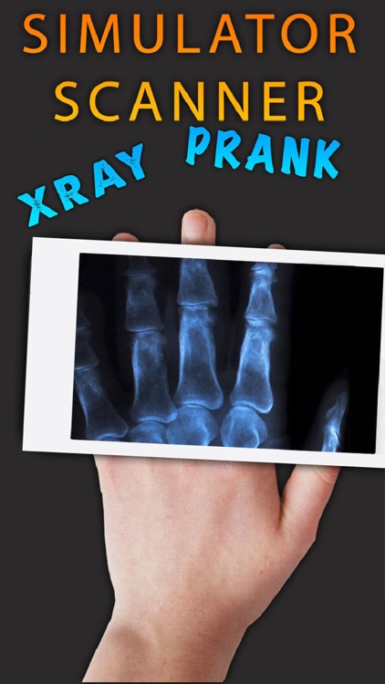 Simulator X-Ray Hand