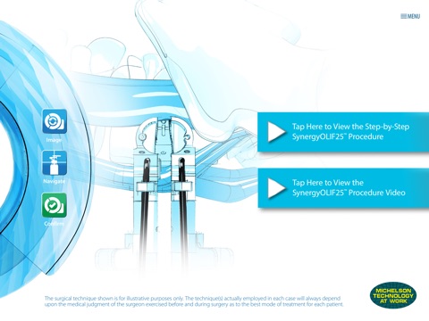 Surgical Synergy Spinal Workflow screenshot 3