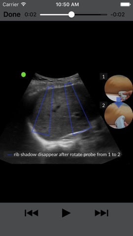 RESUS Ultrasound LITEのおすすめ画像3