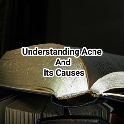 Acne And Its Causes