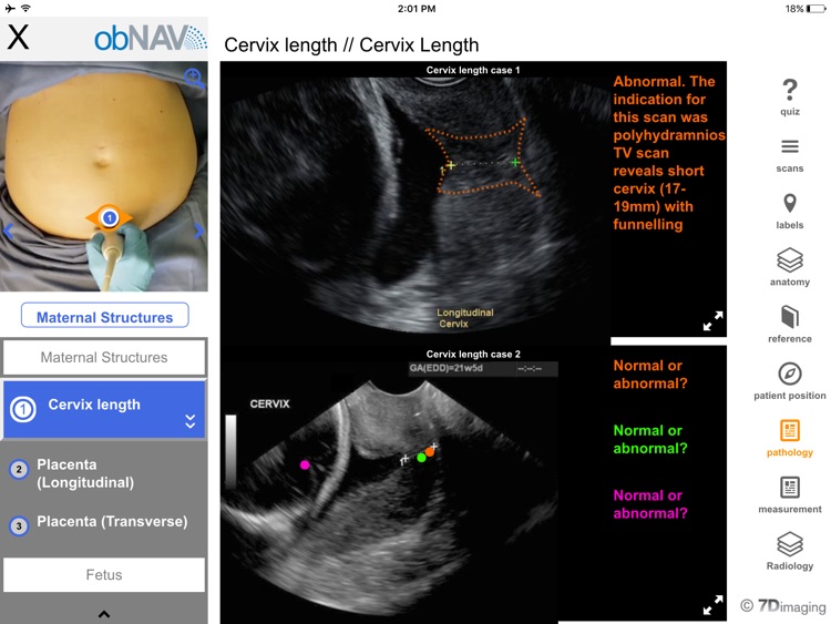 obNAV Español screenshot-3