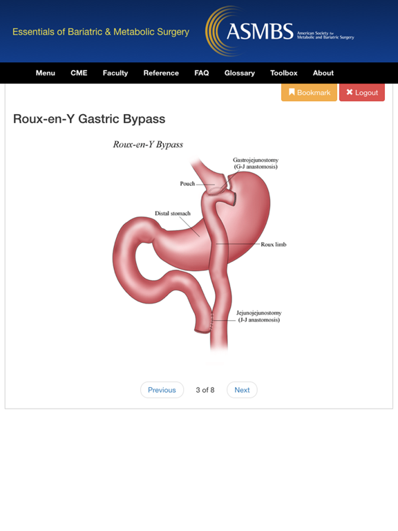 Screenshot #6 pour Essentials of Bariatric & Metabolic Surgery