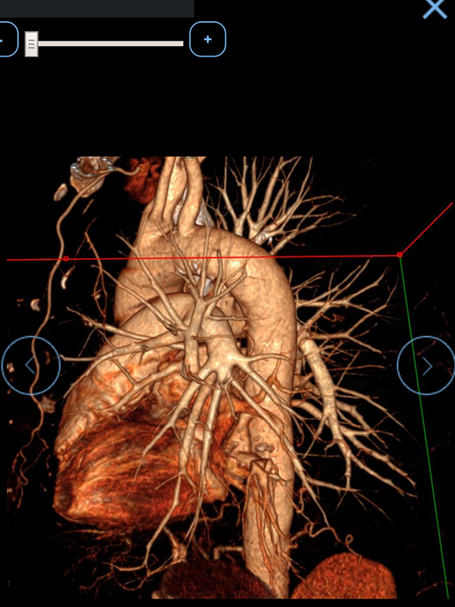 Radeos screenshot 10