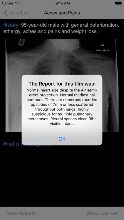 Xrays4Medics screenshot-3