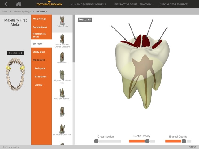Tooth Atlas 8