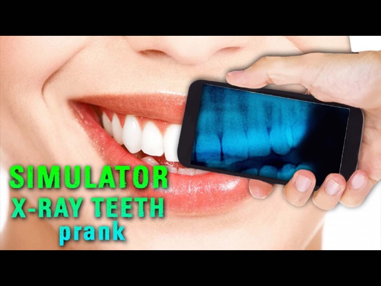 Screenshot #4 pour Simulator X-ray Teeth Prank