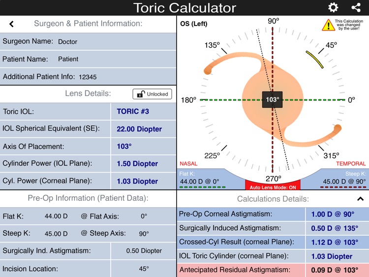 IOL Toric Calculator