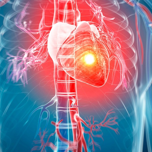 Heart Disease Glossary:Pathophysiology Cheatsheet by Feng Zhang