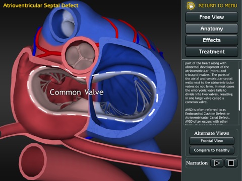 3D Road Map to Congenital Heart Disease screenshot 3