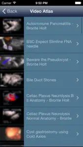 EUS - Diagnostic and Interventional Endoscopic Ultrasound screenshot #4 for iPhone