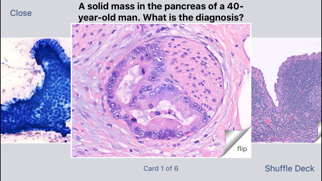 Screenshot #3 pour Johns Hopkins Flashcards