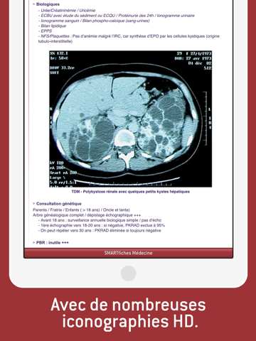 SMARTfiches Nephrologieのおすすめ画像4