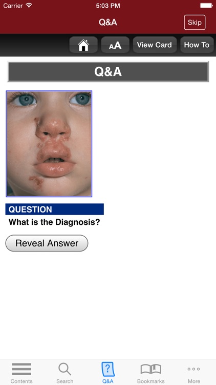 Fitzpatrick's Derm Flash Cards screenshot-4