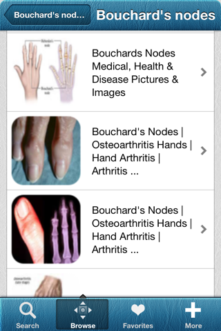 1000 Arthritis Dictionary screenshot 2