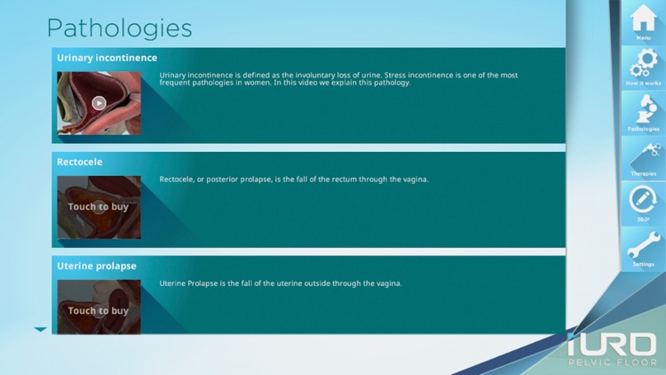 iURO Pelvic Floor