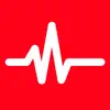 Pulsometr - Heart Rate Monitor problems & troubleshooting and solutions