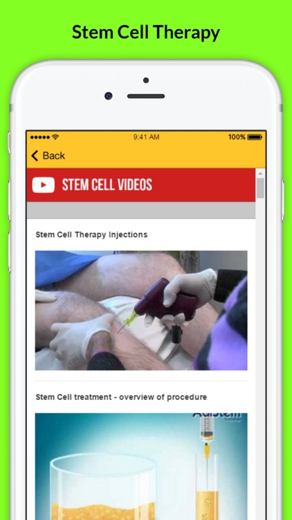 Stem Cell Therapy - Anti aging Treatment screenshot-3
