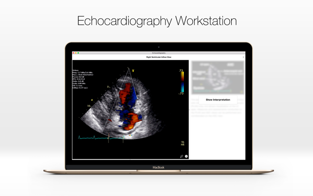 Echocardiography - Case Study and Review(圖2)-速報App