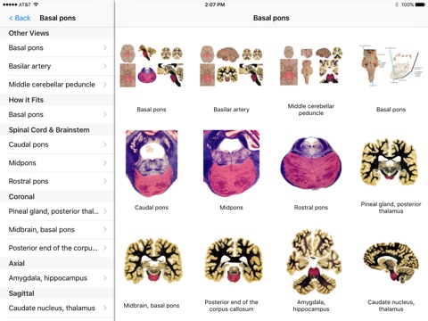 Nolte’s Digital Human Brain screenshot 2