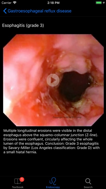 ENDO3® Gastrointestinal Atlas