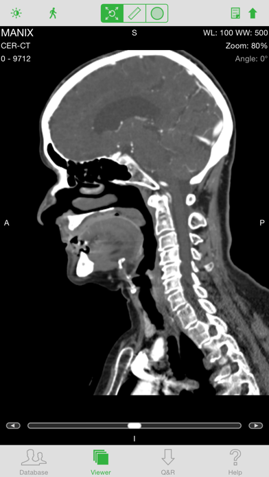 OsiriX HDのおすすめ画像1