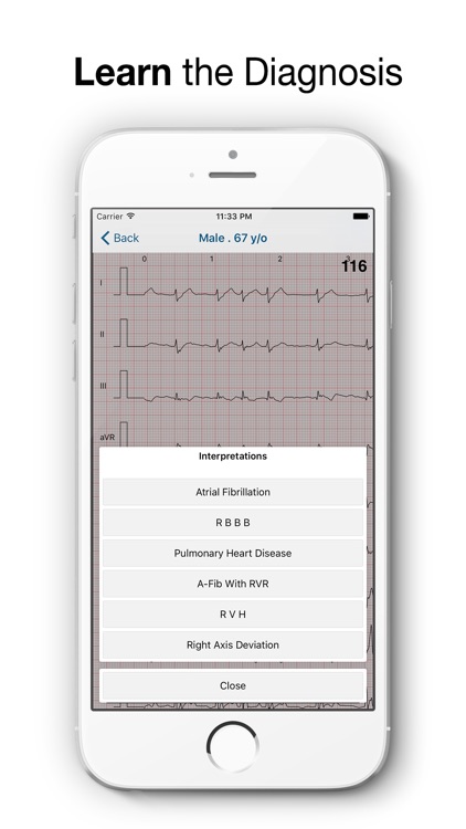 ECG Test Pro - Challenge Your Interpreting Skills screenshot-3