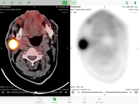 OsiriX HDのおすすめ画像2