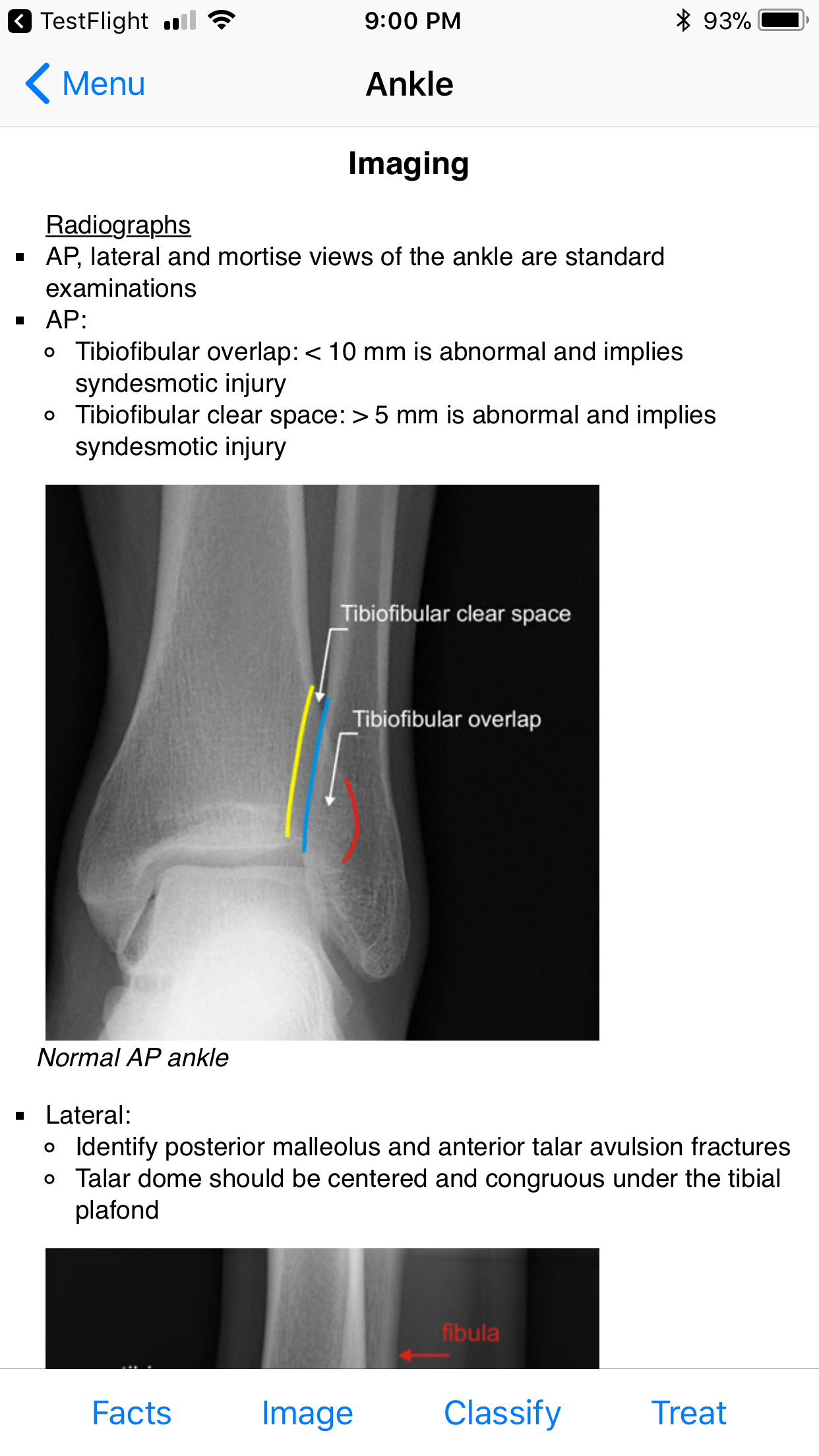 Ortho Traumapedia