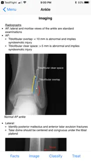 ortho traumapedia iphone screenshot 4