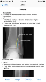 Ortho Traumapedia iphone resimleri 4