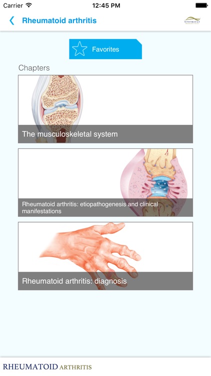 Rheumatoid arthritis Miniatlas