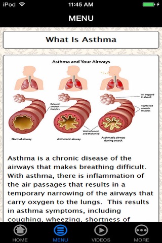 Best Deal with Asthma Naturally Guide & Tips for Beginners screenshot 3