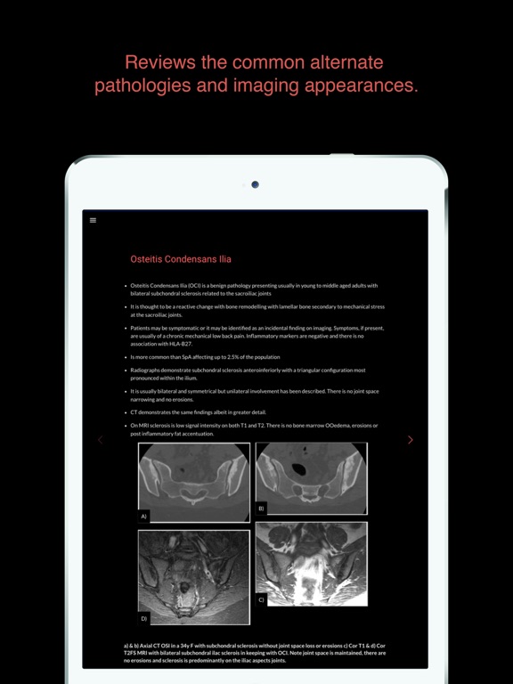 Screenshot #4 pour ESIMR: UnRavelling Spondyloarthropathy