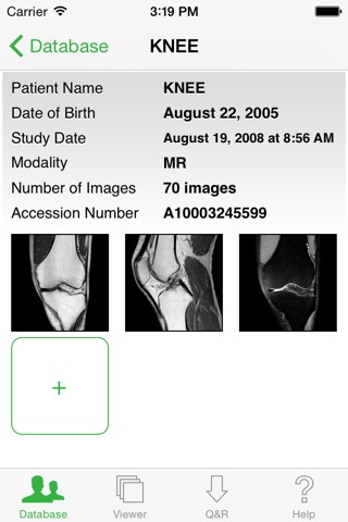 OsiriX HDのおすすめ画像3