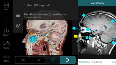 For Organizations - 2017 Human Anatomy Atlasのおすすめ画像2