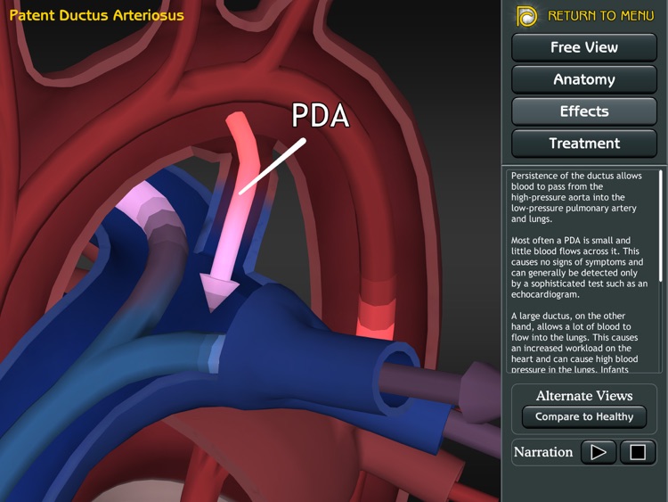 3D Road Map to Congenital Heart Disease screenshot-4