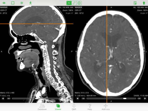 Screenshot #4 pour OsiriX HD