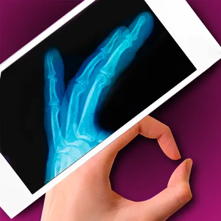 Simulator X-Ray - Finger Prank Cheats