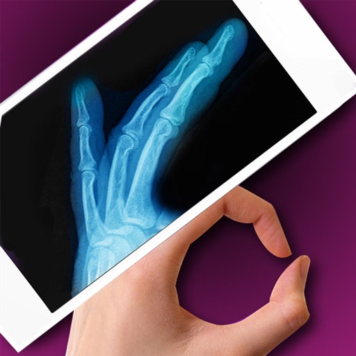 Simulator X-Ray - Finger Prank icon