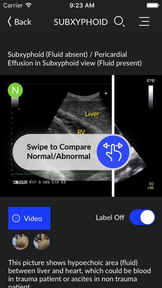 RESUS Ultrasoundのおすすめ画像1