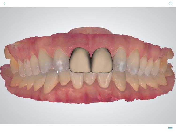 3Shape TRIOS® screenshot-3