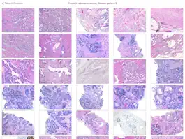 Game screenshot Hopkins Prostate Pathology apk