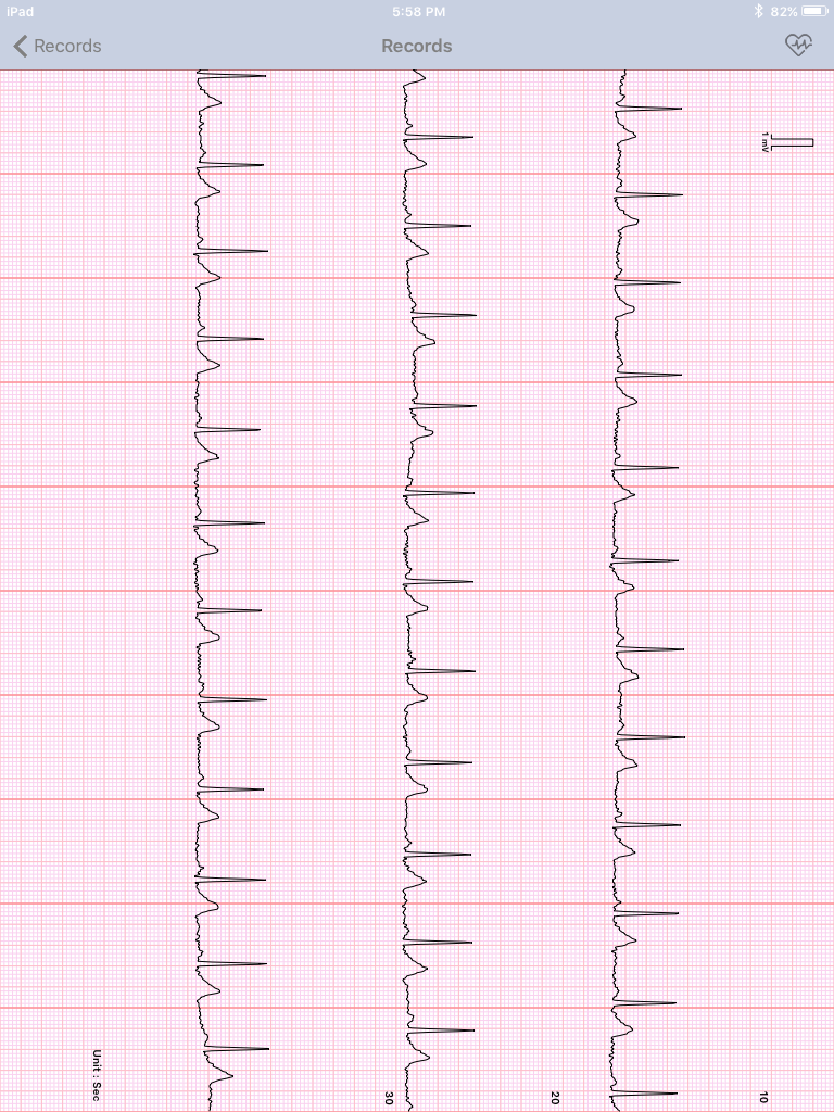 Sanitas ECG Manager