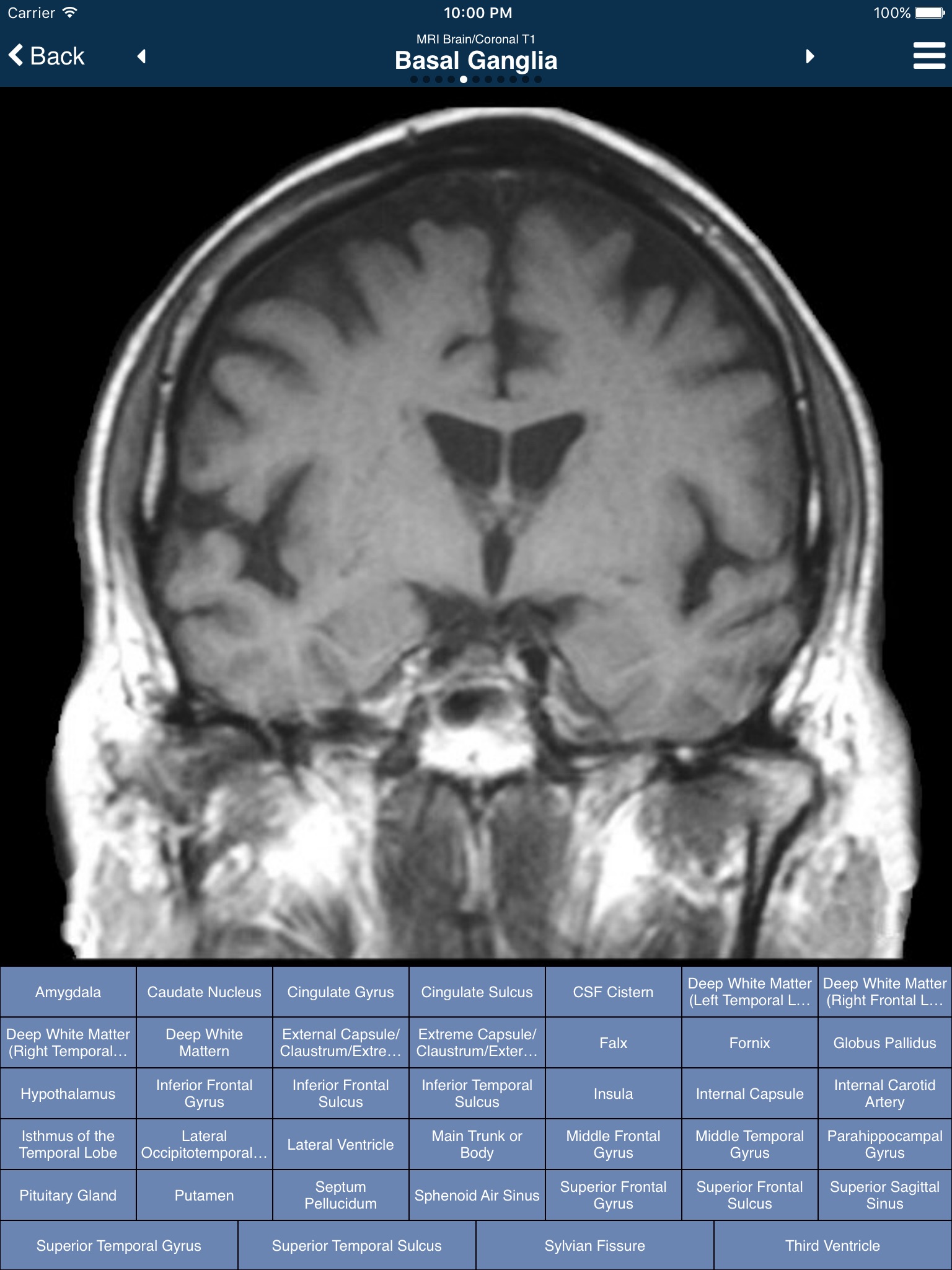 Nina Neuroimaging in Neurology screenshot 3