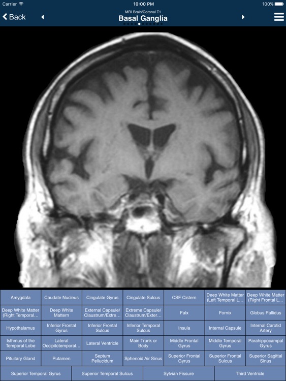 Nina Neuroimaging in Neurology