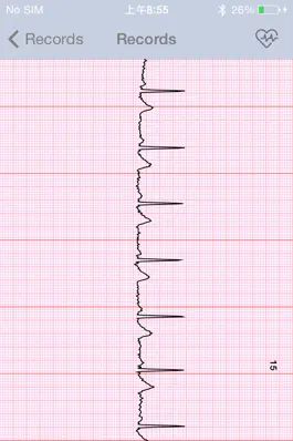 Game screenshot Sanitas ECG Manager mod apk