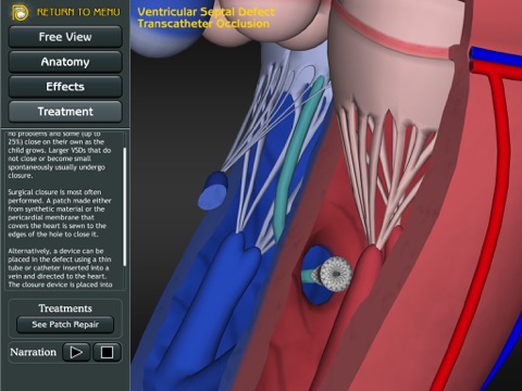 3D Road Map to ASD & VSD screenshot 4