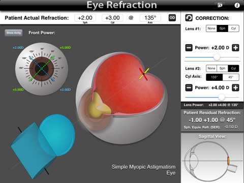 Eye Refraction screenshot 4