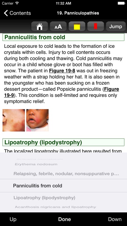 Color Atlas of Pediatric Dermatology